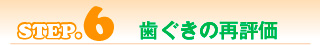 歯ぐきの再評価